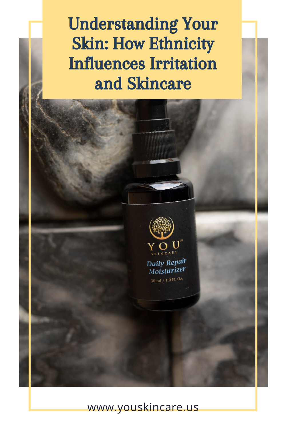 Understanding Your Skin: How Ethnicity Influences Irritation and Skincare