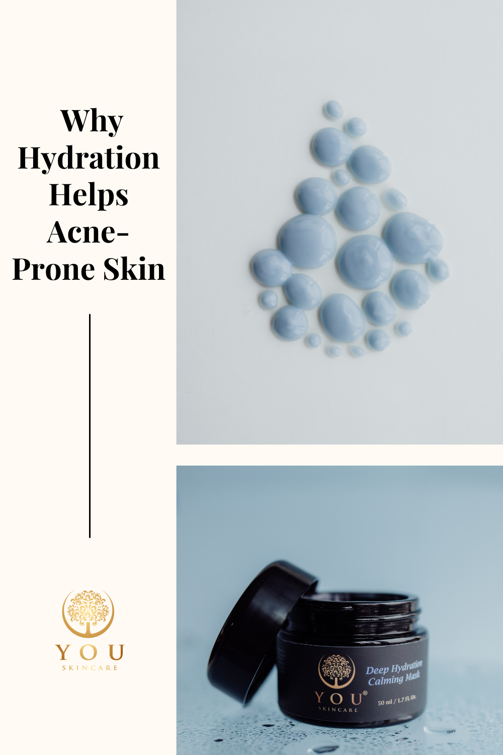 Why Hydration Helps Acne-Prone Skin (And Why Drying It Out Backfires) | YOU Skincare