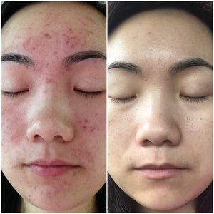 Our Founder's Story.  How YOU Skincare come about....