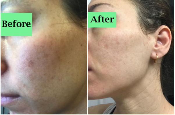 Y.O.U Experience- LM's Testimonial