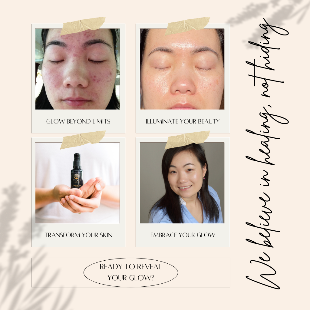 Fade dark spots and even skin tone with YOU Skincare